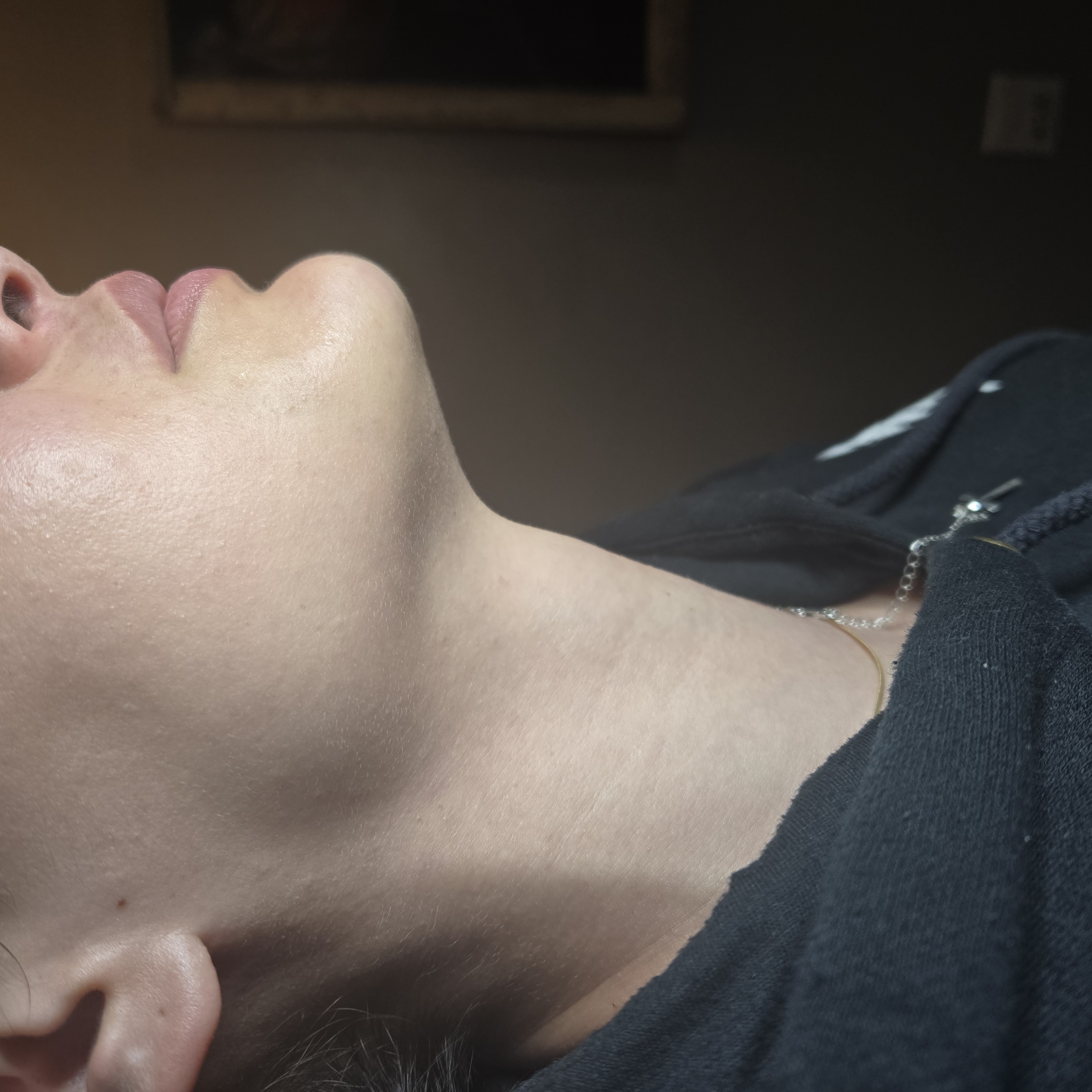 Ultrasonic cavitation / body sculpting results after 1 session New Braunfels TX